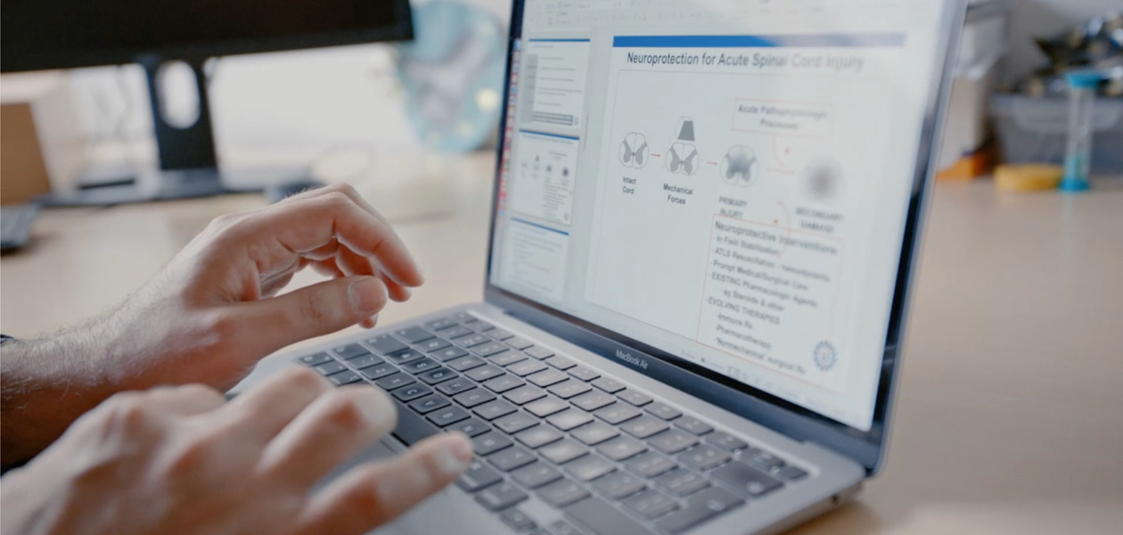 Hænder, der skriver på en MacBook Pro.