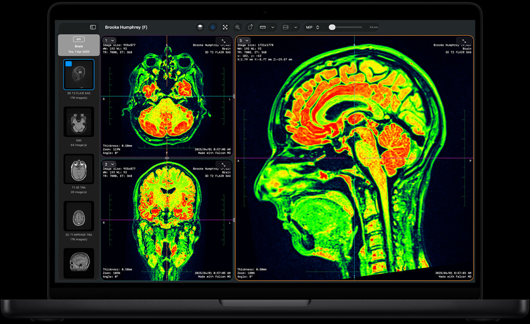 Screen of MacBook Pro showing Falcon MD